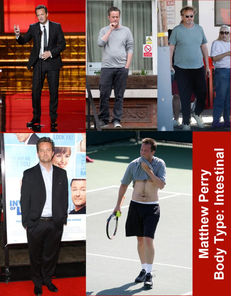 Photo collage of actor Matthew Perry, shown as an example of the Intestinal body type