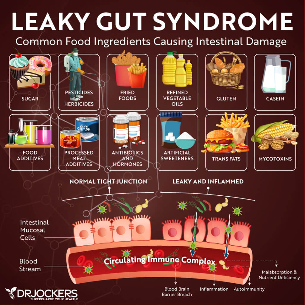 DrJockers infographic on leaky gut syndrome, showing common food ingredients that damage the intestinal lining and a diagram of a normal versus leaky, inflamed gut junction