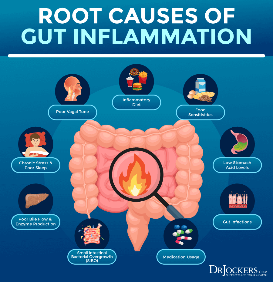 DrJockers infographic on the root causes of gut inflammation, including inflammatory diet, food sensitivities, chronic stress, low stomach acid, SIBO, and medication use